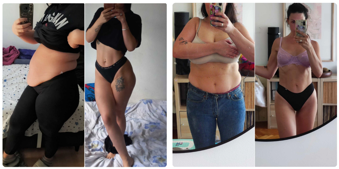 dijastaza transformacija orozovic